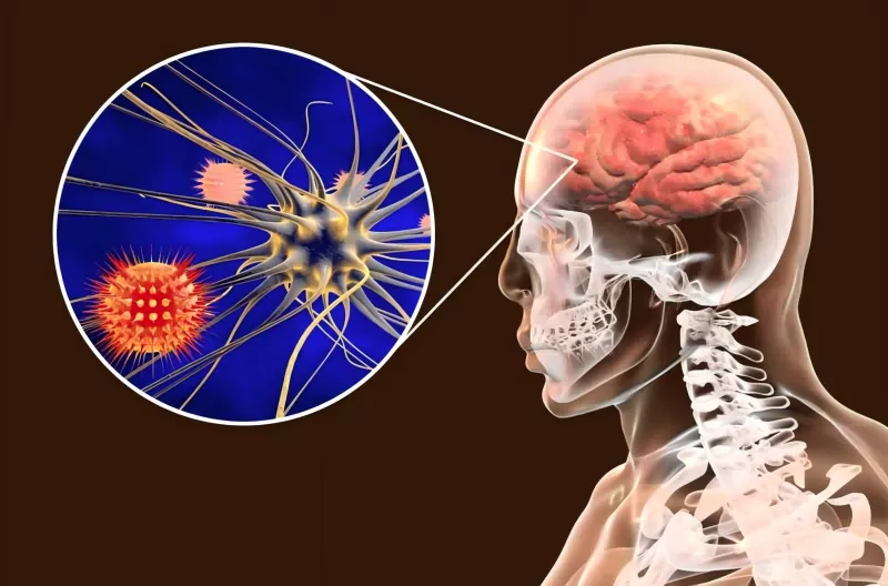 Gids voor meningokokkenvaccins